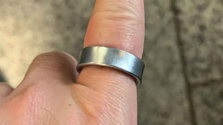 galaxy ring swollen finger