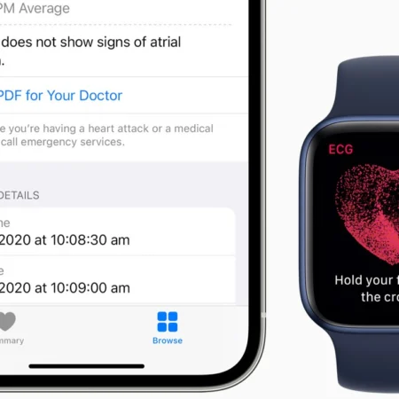 Apple Watch ECG
