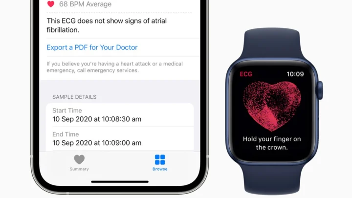 Apple Watch ECG